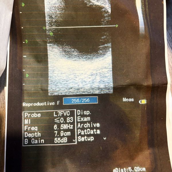Ultraschallgerät CTS-800 – Bild 2